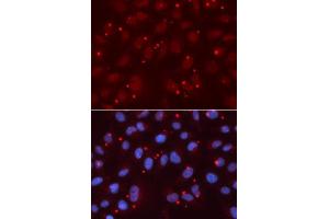 Immunofluorescence (IF) image for anti-X-Ray Repair Complementing Defective Repair in Chinese Hamster Cells 3 (XRCC3) (AA 62-346) antibody (ABIN3023006)