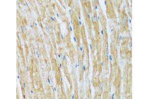 Immunohistochemistry of paraffin-embedded Mouse heart using BAG3 Polyclonal Antibody at dilution of 1:100 (40x lens). (BAG3 antibody)