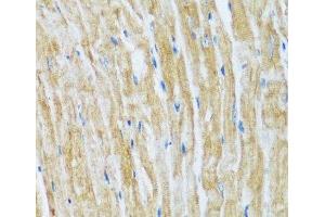 Immunohistochemistry of paraffin-embedded Mouse heart using BAG3 Polyclonal Antibody at dilution of 1:100 (40x lens).