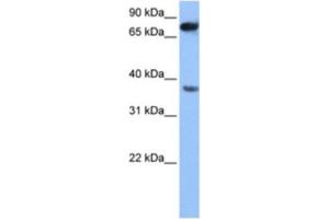Western Blotting (WB) image for anti-Zinc Finger, CCHC Domain Containing 12 (ZCCHC12) antibody (ABIN2463550) (ZCCHC12 antibody)