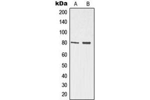 Western blot analysis of p73 expression in Jurkat (A), HeLa (B) whole cell lysates. (Tumor Protein p73 antibody  (N-Term))