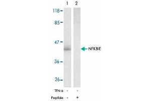 Western blot analysis of extracts from 293 cells untreated or treated with TNF-alpha (20 ng/mL, 15 min) using NFKBIE polyclonal antibody .