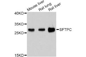 Western blot analysis of extracts of various cell lines, using SFTPC Antibody (ABIN4905145) at 1:1000 dilution.
