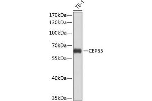 Western blot analysis of extracts of THP-1 cells, using CEP55 antibody (ABIN6127692, ABIN6138423, ABIN6138424 and ABIN6224249) at 1:1000 dilution. (CEP55 antibody  (AA 1-260))