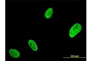 Immunofluorescence of monoclonal antibody to RUNX2 on U-2 OS cell. (RUNX2 antibody  (AA 251-350))