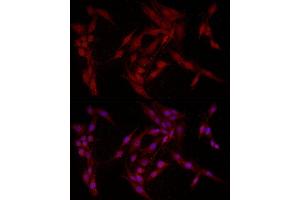 Immunofluorescence analysis of PC-12 cells using F Rabbit pAb (ABIN6127814, ABIN6140422, ABIN6140423 and ABIN6221993) at dilution of 1:200 (40x lens). (FABP5 antibody  (AA 1-135))