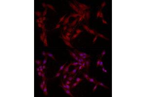 Immunofluorescence analysis of PC-12 cells using F Rabbit pAb (ABIN6127814, ABIN6140422, ABIN6140423 and ABIN6221993) at dilution of 1:200 (40x lens). (FABP5 antibody  (AA 1-135))
