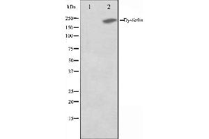 Western blot analysis on K562 cell lysate using Dysferlin Antibody,The lane on the left is treated with the antigen-specific peptide. (Dysferlin antibody  (C-Term))