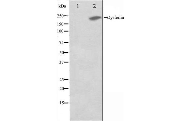 Dysferlin antibody  (C-Term)