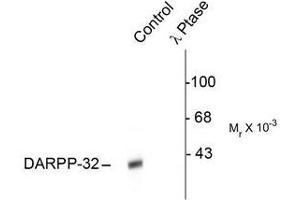 Image no. 1 for anti-Protein Phosphatase 1, Regulatory (Inhibitor) Subunit 1B (PPP1R1B) (pThr34) antibody (ABIN372606) (DARPP32 antibody  (pThr34))