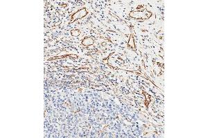 Immunohistochemical analysis of paraffin-embedded human appendix tissue using (ABIN658983 and ABIN2838032) performed on the Leica® BOND RXm. (CD34 antibody  (AA 185-214))