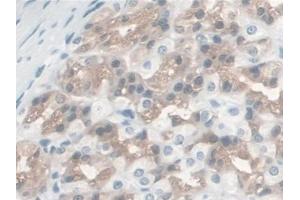 DAB staining on IHC-P; Samples: Rat Stomach Tissue (S100A16 antibody  (AA 1-97))