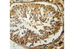 Immunohistochemistry analysis in human testis carcinoma (Formalin-fixed, Paraffin-embedded) using SERAC1  Antibody  (C-term), followed by peroxidase conjugation of the secondary antibody and DAB staining. (SERAC1 antibody  (C-Term))