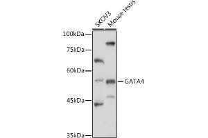 Western blot analysis of extracts of various cell lines, using G antibody (ABIN6133721, ABIN6140975, ABIN6140976 and ABIN6217864) at 1:1000 dilution. (GATA4 antibody  (AA 50-150))
