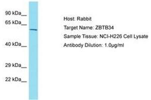 Image no. 1 for anti-Zinc Finger and BTB Domain Containing 34 (ZBTB34) (AA 108-157) antibody (ABIN6750816) (ZBTB34 antibody  (AA 108-157))