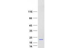 Validation with Western Blot