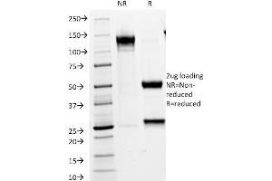 SDS-PAGE Analysis Purified VLDL-Receptor Mouse Monoclonal Antibody (VLDLR/1337). (VLDLR antibody  (C-Term))