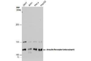 WB Image Insulin Receptor beta subunit antibody detects Insulin Receptor beta subunit protein by western blot analysis.