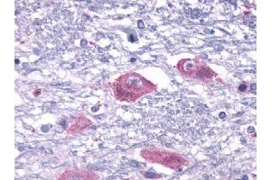 Immunohistochemical staining of Brain (Neurons and glia) using anti- PTHR2 antibody ABIN122362