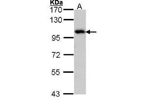 ADAM15 anticorps  (N-Term)