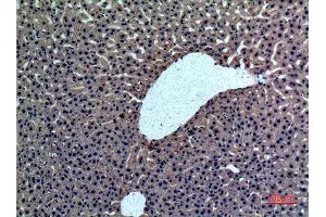 Immunohistochemistry (IHC) analysis of paraffin-embedded Rat liver, antibody was diluted at 1:100. (Prothrombin antibody  (Internal Region))