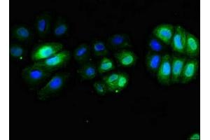 Immunofluorescent analysis of A549 cells using ABIN7171382 at dilution of 1:100 and Alexa Fluor 488-congugated AffiniPure Goat Anti-Rabbit IgG(H+L) (CD3 epsilon antibody  (AA 23-126))