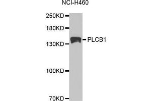Western blot analysis of extracts of NCI-H460 cells, using PLCB1 antibody. (Phospholipase C beta 1 antibody)