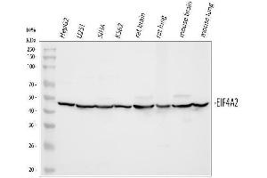 Western blot analysis of eIF4A2 using anti-eIF4A2 antibody (ABIN3043426). (EIF4A2 antibody  (N-Term))