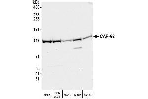 anti-Non-SMC Condensin II Complex, Subunit G2 (NCAPG2) (C-Term) antibody
