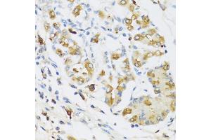 Immunohistochemistry of paraffin-embedded human stomach using RNASE3 antibody. (RNASE3 antibody)
