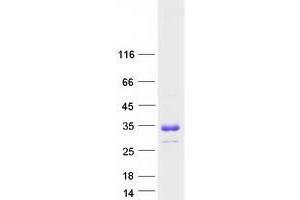 Validation with Western Blot (TMUB1 Protein (Transcript Variant 1) (Myc-DYKDDDDK Tag))