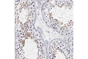 Immunohistochemical staining (Formalin-fixed paraffin-embedded sections) of human testis shows moderate cytoplasmic and nuclear positivity in seminiferous ducts with ODF2 polyclonal antibody .