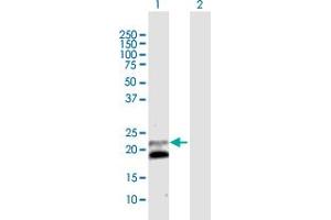 Western Blot analysis of IFNB1 expression in transfected 293T cell line by IFNB1 MaxPab polyclonal antibody.