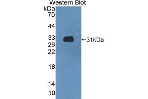 Detection of Recombinant CCDC60, Mouse using Polyclonal Antibody to Coiled Coil Domain Containing Protein 60 (CCDC60) (CCDC60 antibody  (AA 1-186))