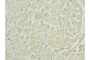 Immunohistochemistry of paraffin-embedded human heart tissue using ABIN7157743 at dilution of 1:100 (KCNIP2 antibody  (AA 1-90))