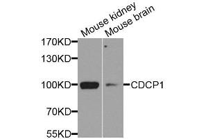 Western blot analysis of extracts of various cell lines, using CDCP1 antibody. (CDCP1 antibody  (AA 30-343))