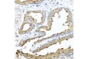 Immunohistochemistry of paraffin-embedded human prostate using NCK2 antibody at dilution of 1:100 (x40 lens).