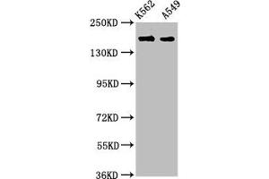 Western Blot Positive WB detected in: K562 whole cell lysate, A549 whole cell lysate All lanes: FMN1 antibody at 3. (FMN1 antibody  (AA 354-487))