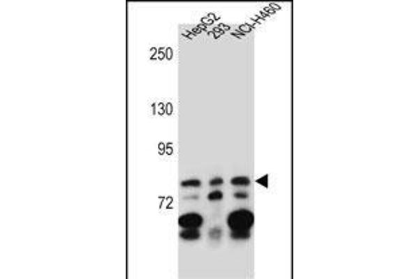 ZNF555 anticorps  (C-Term)
