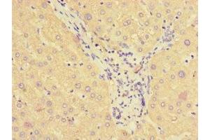 Immunohistochemistry of paraffin-embedded human liver tissue using ABIN7170841 at dilution of 1:100 (SMAP1 antibody  (AA 1-280))