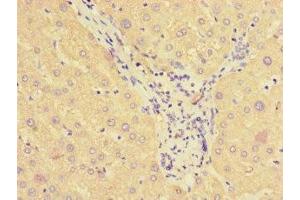 Immunohistochemistry of paraffin-embedded human liver tissue using ABIN7170841 at dilution of 1:100 (SMAP1 antibody  (AA 1-280))