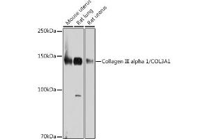 Western blot analysis of extracts of various cell lines, using Collagen III alpha 1/COL3 antibody (ABIN7266459) at 1:1000 dilution. (COL3 antibody)