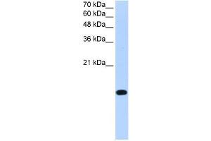 BATF2 antibody used at 0. (BATF2 antibody  (Middle Region))