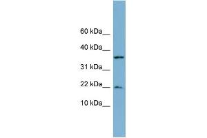 WB Suggested Anti-DUSP10 Antibody Titration: 0.