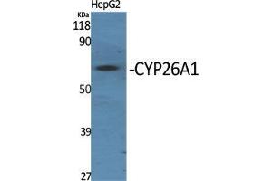 Western Blot (WB) analysis of specific cells using CYP26A1 Polyclonal Antibody. (CYP26A1 antibody  (Internal Region))