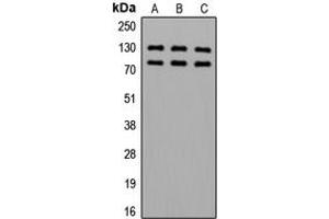 Western blot analysis of Alpha-adducin (pS726/713) expression in HeLa (A), SP2/0 (B), PC12 (C) whole cell lysates.