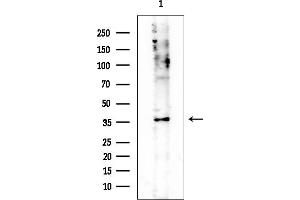 anti-ALX Homeobox 1 (ALX1) antibody