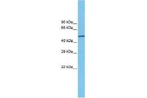 Host:  Rabbit  Target Name:  CHRNA7  Sample Type:  MDA-MB-435S Cell lysates  Antibody Dilution:  1. (CHRNA7 antibody  (N-Term))