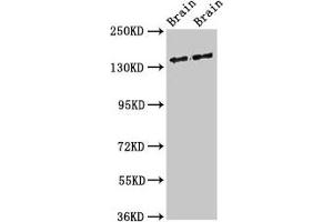 Western Blot Positive WB detected in: Rat brain tissue, Mouse brain tissue All lanes: MAST3 antibody at 3 μg/mL Secondary Goat polyclonal to rabbit IgG at 1/50000 dilution Predicted band size: 144 kDa Observed band size: 144 kDa (MAST3 antibody  (AA 1101-1309))