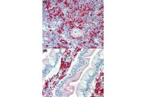 Immunohistochemical staining (Formalin-fixed paraffin-embedded sections) of human thymus tissue (A) and human small intestine tissue (B) using HLA Class II beta chains (DP, DQ, DR) monoclonal antibody, clone WR18  under 10 ug/mL working concentration. (HLA-DRB1 antibody)